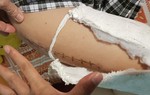 Cô chủ nhiệm của học sinh gãy chân: 'Hiệu trưởng bịa đặt quá nhiều'