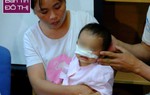 Mẹ mải nấu cơm, bé 1 tuổi bị chó nhà cắn mất mũi