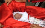 Thai nhi tử vong bất thường, bác sĩ khẳng định không liên quan