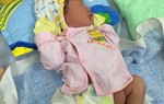 Vụ mổ đẻ làm gãy chân trẻ: Bệnh viện phải bồi thường nếu có lỗi