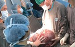 Giải thoát cho nữ bệnh nhân 30 tuổi khỏi khối u 'khủng' nặng 20kg
