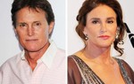 Loạt sao Hollywood lộ gương mặt “biến dạng” vì phẫu thuật thẩm mỹ