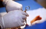  80 trẻ bị sùi mào gà sau khi cắt bao quy đầu ở phòng khám tư