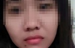 Cô dâu Việt kêu cứu vì chồng tâm thần người Trung Quốc đánh đập