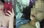 Cô gái xinh đẹp bị rạch mặt ở Bắc Ninh do mâu thuẫn cá nhân