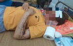 Vụ nữ phụ bếp bị tạt axit ở Hòa Bình: Từng bị nhắn tin dọa giết cả nhà