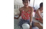 Đình chỉ bác sĩ tắc trách khiến nữ sinh cưa chân