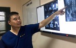 Bệnh nhân phải cắt một bên thận vì tự ý điều trị sỏi thận bằng thuốc lá
