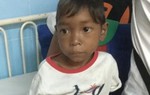 15 con giun đũa trong bụng cậu bé Ma Coong