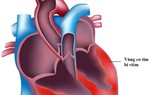 Bộ Y tế lên tiếng về virus lây lan bệnh Viêm cơ tim