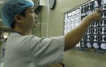 Nguy kịch vì chữa hóc xương gà theo kinh nghiệm dân gian