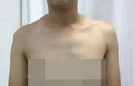 Việt Nam đang chuẩn bị cho ca phẫu thuật chuyển giới đầu tiên