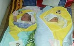 Hiếm gặp: Cặp song sinh chào đời còn nguyên trong bọc ối