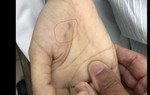 Chủ quan, nữ bác sĩ thú y tử vong vì bị chó dại cắn