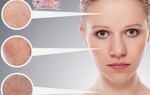 Thu Cúc ưu đãi khủng lên đến 100% thẻ Gift làm đẹp dịp cuối năm
