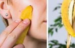 Ngoài tuyệt chiêu làm đẹp, vỏ chuối còn giúp làm giảm cơn đau nửa đầu