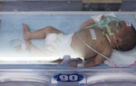 10 ngày tuổi đã bị uốn ván nguy kịch