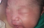 Bé gái vừa chào đời đã mọc 2 răng cửa