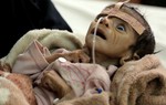 Yemen: 2,9 triệu phụ nữ và trẻ em đang sống dở chết dở vì đói
