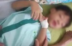 Phát bệnh dại do bị chó cắn, bé 5 tuổi tử vong