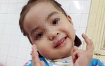 'Giải cứu' bé gái 4 tuổi khỏi u quái vùng mặt