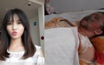 Cô gái trẻ bị bỏng nặng toàn thân