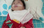 Bé 6 tuổi teo não sau điều trị, Bệnh viện Nhi TƯ khẳng định đã làm hết sức