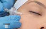 Spa tiêm filler cho người phụ nữ dẫn đến mù mắt hoạt động không phép