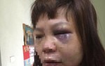 Công an triệu tập người chồng vũ phu đưa vợ lên đồi cắt gân chân