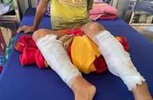 Quảng Bình: Điều tra việc bé trai bị cha đốt bỏng 2 chân