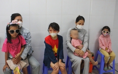 Số ca đau mắt đỏ tăng nhanh báo động, Đà Nẵng chỉ đạo khẩn