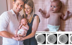Em bé đầu tiên chào đời bằng kỹ thuật IVF tự động