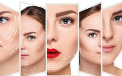 Căng chỉ Be-Young kết hợp đa công nghệ nâng cơ giúp trẻ hoá, xoá nhăn 