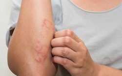 Những bộ phận trên cơ thể bị ngứa nên đi khám sớm, cẩn thận có thể là ung thư