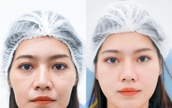 Vén màn bí mật về siêu phẩm tái sinh đa tầng đang làm mưa làm gió trên thị trường làm đẹp
 
