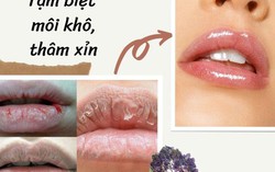 3 cách dưỡng môi căng mịn ngày đông