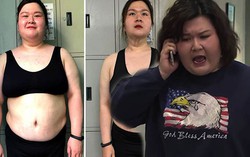 Hút mỡ bất thành, "hotgirl trăm ký" Về nhà đi con tự thân giảm cân: Da chùng nhão thấy thương