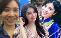 "Người tình thiếu gia Phan Hải" khoe nhan sắc khác lạ hậu thẩm mỹ nụ cười rùng rợn