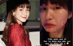 Một phút lầm lỡ bị mụn hành, Hòa Minzy thất thế ngôi vương, mặt mộc không tì vết