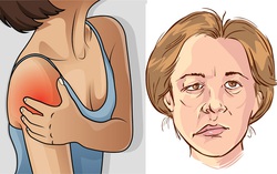 1001 nguyên nhân gây đột quỵ ít ai ngờ tới