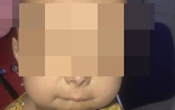 Bé 6 tuổi có nhiều bộ phận lão hóa như người già