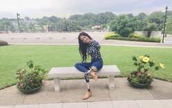 “Nữ chiến binh’’ mất 2 tay và 1 chân