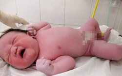 Bé sơ sinh nặng gần 5,4 kg