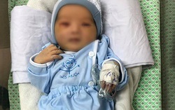 Bé sơ sinh bị bỏ rơi ở hố ga: Bé bị nhiễm trùng huyết, có hiện tượng kháng kháng sinh, bác sĩ không dám nói trước điều gì?