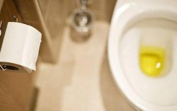 Khi đi vệ sinh nếu thấy 3 dấu hiệu này xuất hiện, nên đi khám gan ngay kẻo muộn