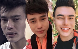 Xuất hiện nghệ sĩ nam phẫu thuật thẩm mỹ còn nhiều hơn cả chị em Vbiz