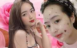 Tự làm mặt nạ collagen hoa hồng cho da căng mịn, trắng hồng