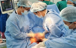 Cứu sống trẻ sơ sinh non tháng có u quái to