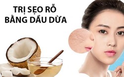Cách trị sẹo rỗ trên mặt lâu năm tại nhà hiệu quả nhanh nhất