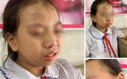 Hà Giang: Đình chỉ dạy 3 tháng với cô giáo tát học sinh lớp 4 trong lớp 